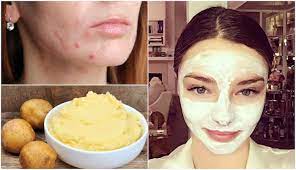 how-to-use-potato-for-skin-care-potato-beauty-tips-in-gujarati