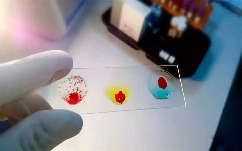 gujarati-man-found-with-rarest-blood-group-emm-negative