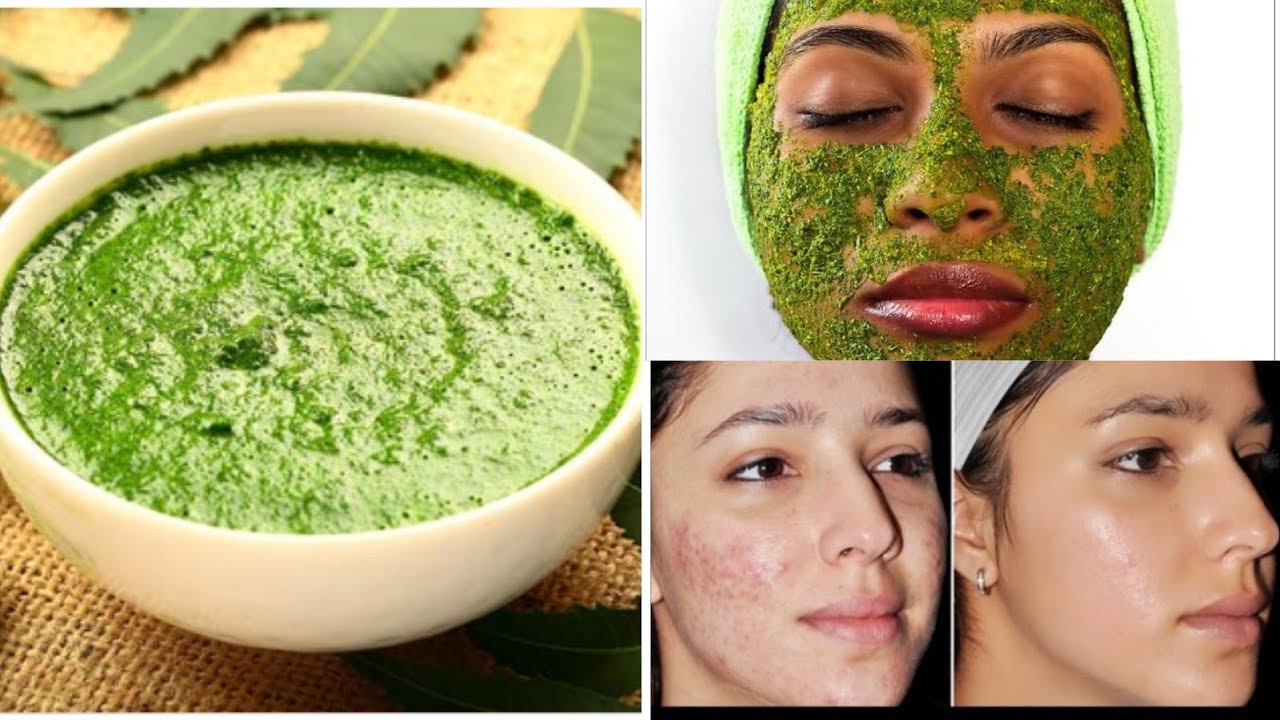 treat-skin-related-problems-in-monsoon-at-home