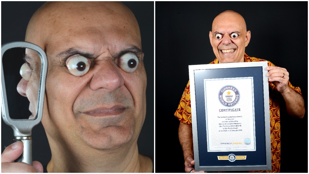  a-man-can-pop-out-his-eyes-won-guinness-world-record