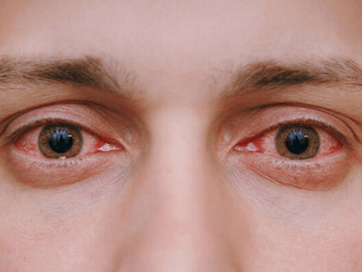 These organs indicate rising sugar levels, know what are the early symptoms