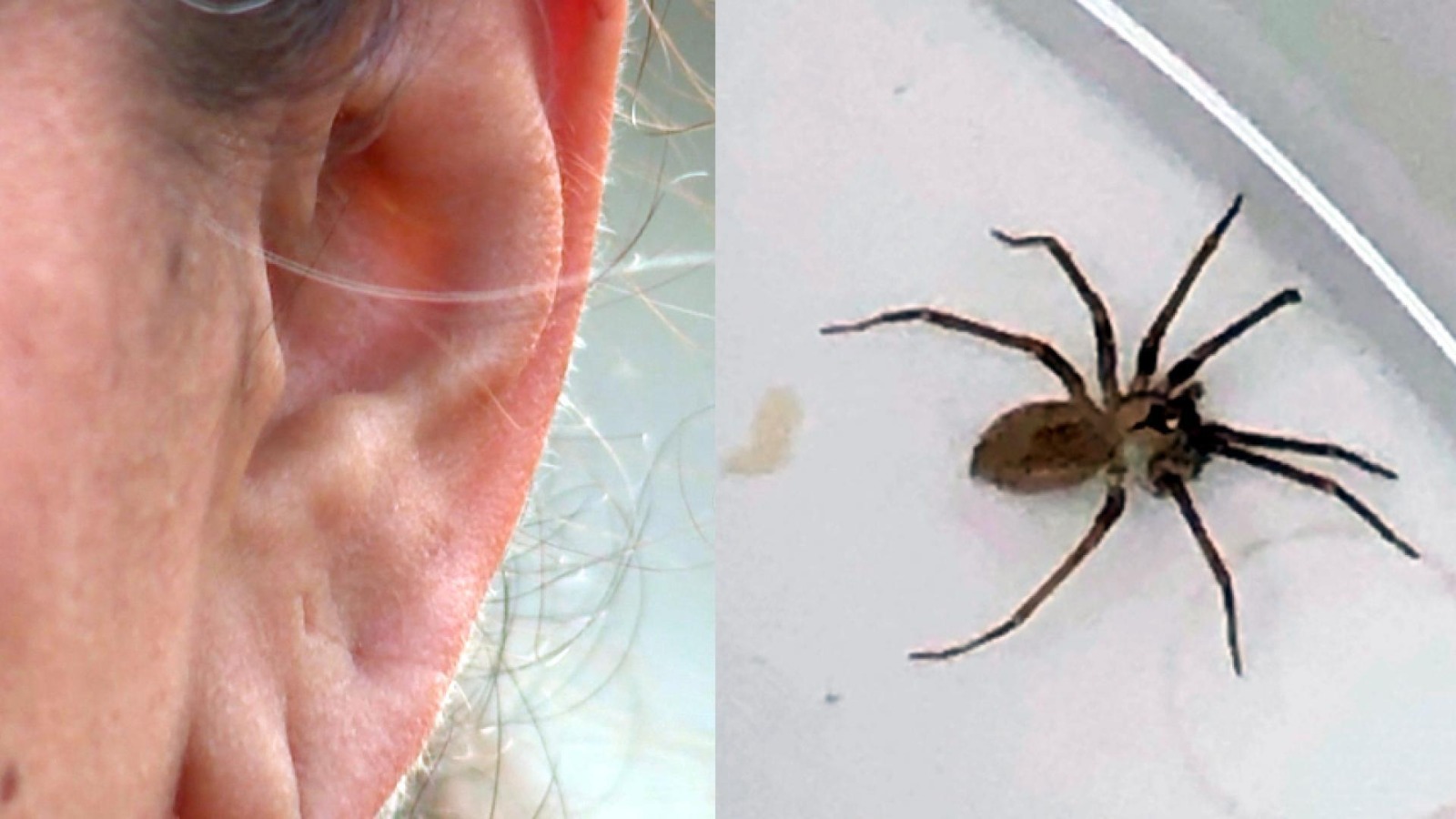 A living spider was making a home in her ear, hearing a strange sound, the woman went to the doctor
