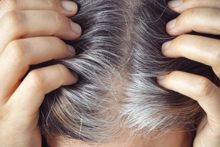 Is your hair also turning gray prematurely? So these reasons could be behind it
